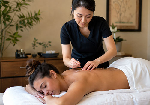 acupuncture